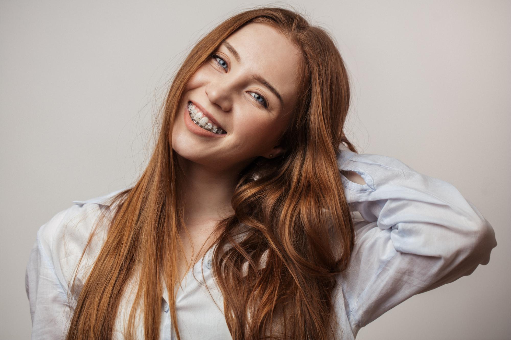 clear Braces-annie clear Braces-annie