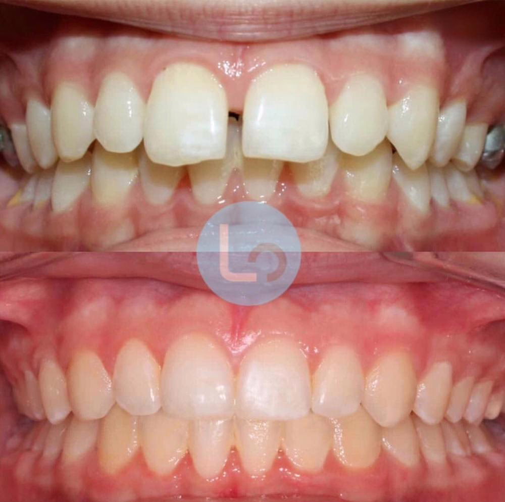 before and after photo