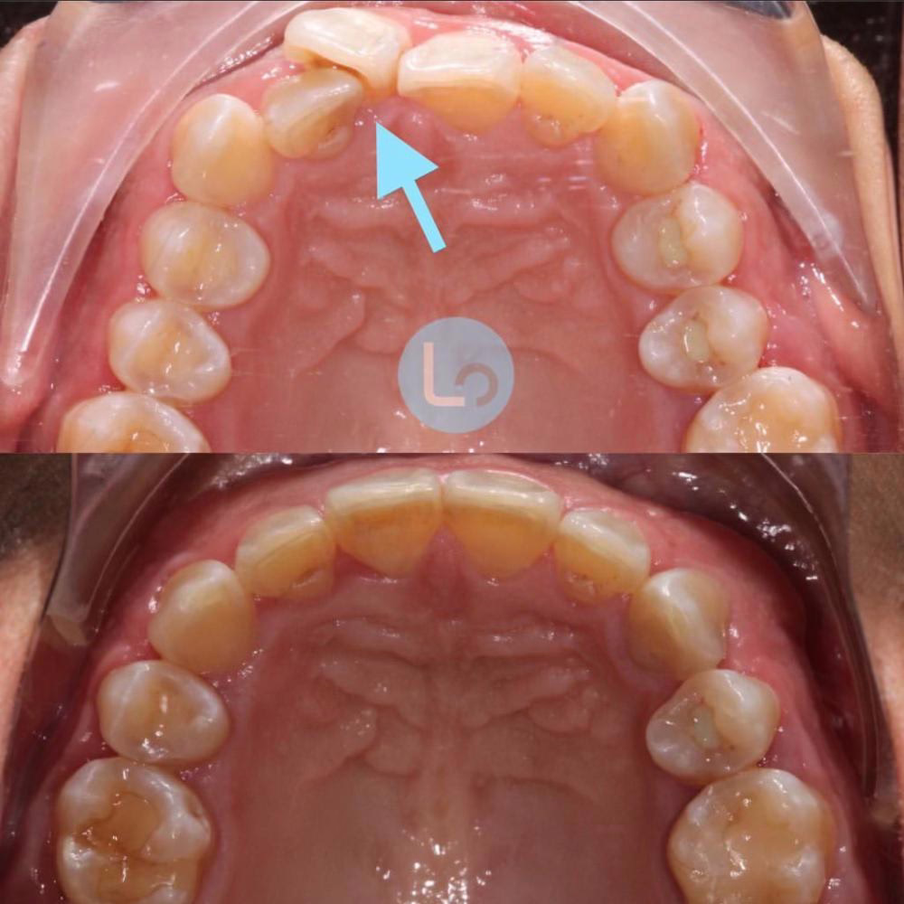 before and after photo