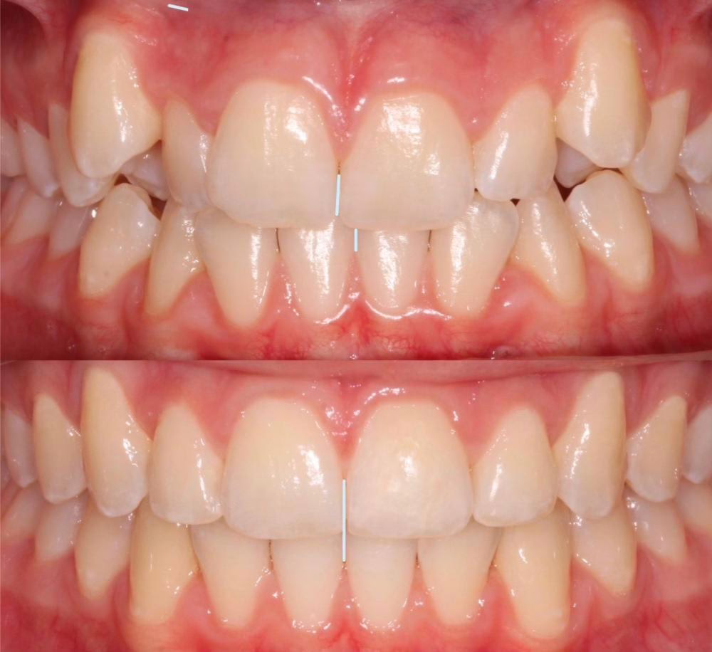 before and after photo