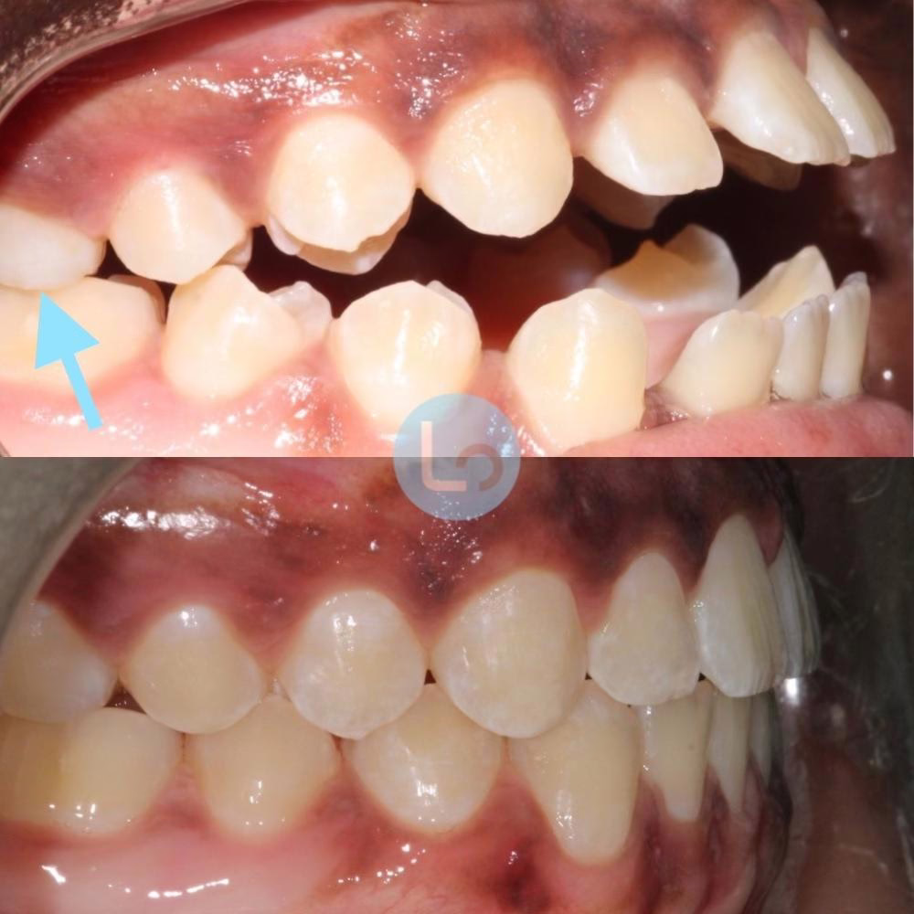 before and after photo