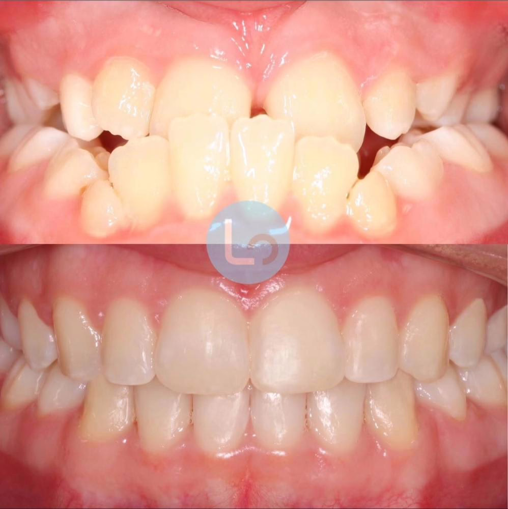 before and after photo