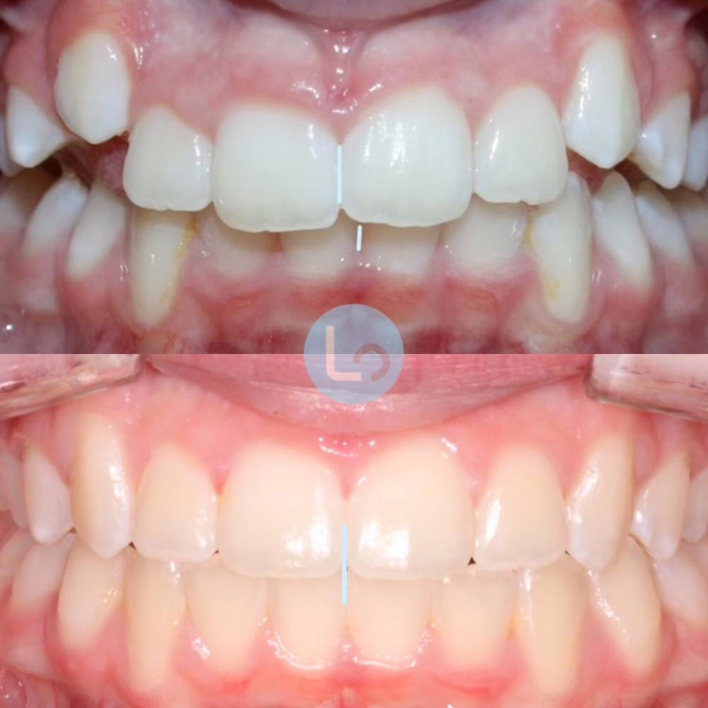 before and after photo