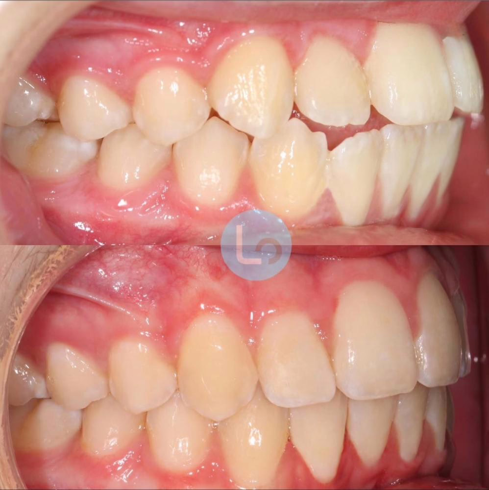 before and after photo